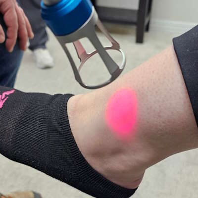 Class 4 laser therapy for ankle injury recovery at Hanson Chiropractic Center.