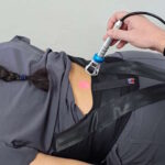Patient receiving Class IV laser for lower back pain at Hanson Chiropractic.