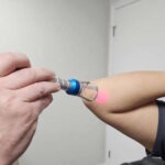 Dr. Justin McGinn using Class IV laser for elbow pain relief in Edmond.